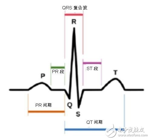 ͼһĵͼе P-QRS-T